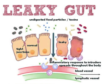 leaky-Gut